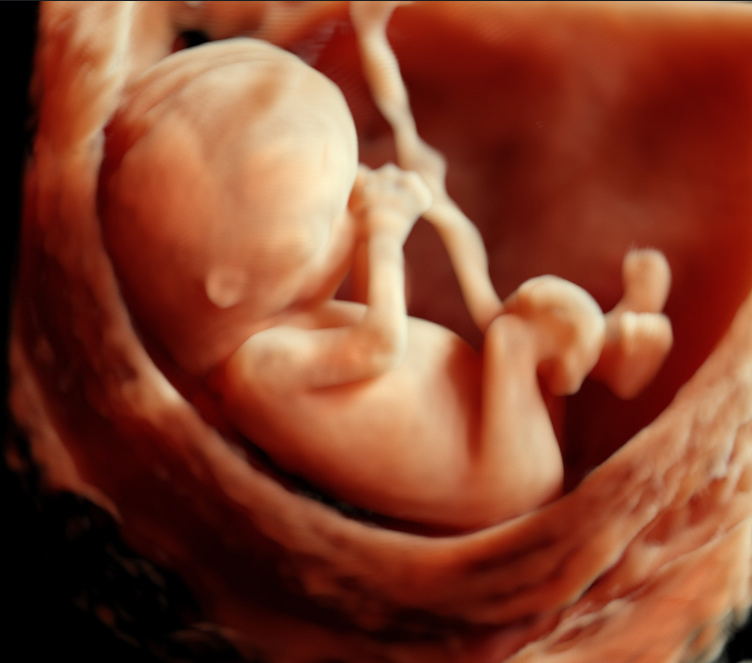 Ultrasona Fetal Fotos - Unparalleled HD Live & 3D/4D Ultrasound Imaging ...